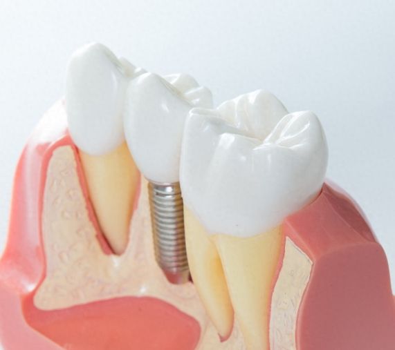 http://www.chicagonutritionsolutions.com/d/file/news/cyggt98ega5v.jpg