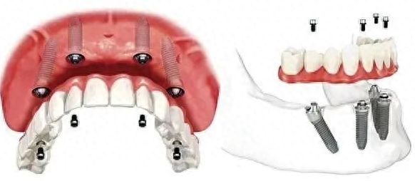 http://www.chicagonutritionsolutions.com/d/file/news/nb0lv0ej15.jpg