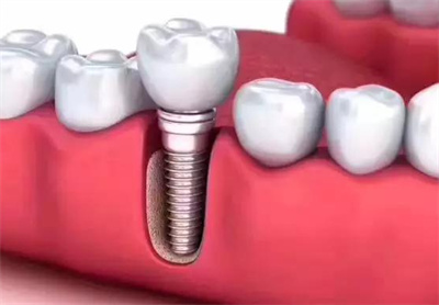 http://www.chicagonutritionsolutions.com/d/file/price/0eox3sirocvk.jpg