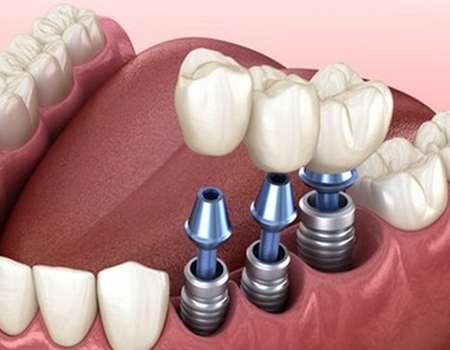 http://www.chicagonutritionsolutions.com/d/file/price/0ka4ectou5bg.jpg