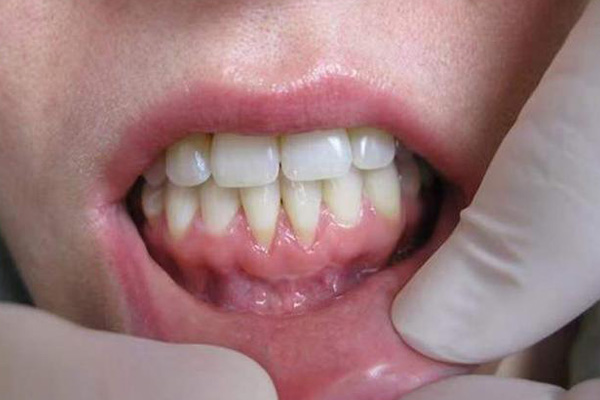 http://www.chicagonutritionsolutions.com/d/file/price/0kkp1a4w4ksv.jpg