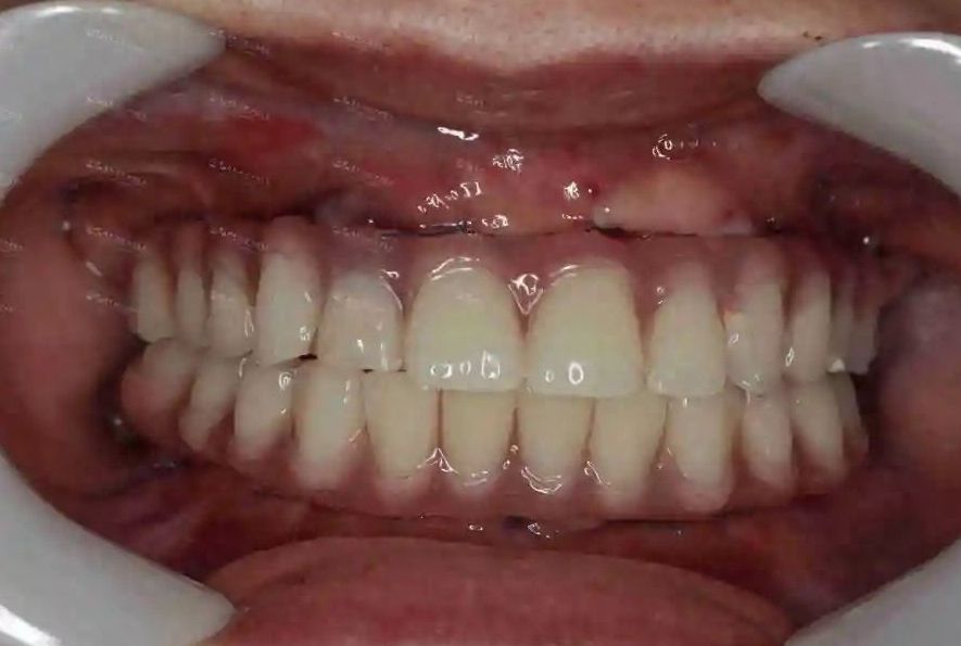 http://www.chicagonutritionsolutions.com/d/file/price/0l6uk9jmxxv8.jpg