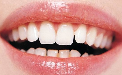 http://www.chicagonutritionsolutions.com/d/file/price/1002275785.jpg