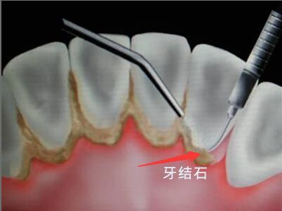 http://www.chicagonutritionsolutions.com/d/file/price/1339145197.jpg