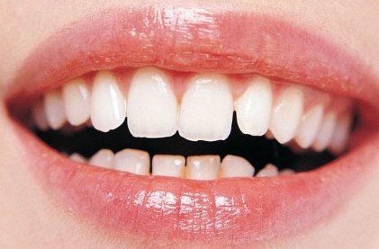 http://www.chicagonutritionsolutions.com/d/file/price/1429187140.jpg