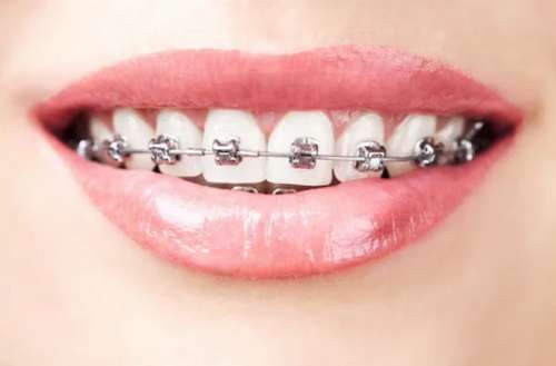 http://www.chicagonutritionsolutions.com/d/file/price/246spw1r0f8i.jpg