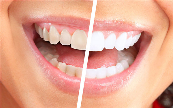 http://www.chicagonutritionsolutions.com/d/file/price/2JO56WH4R6.jpg