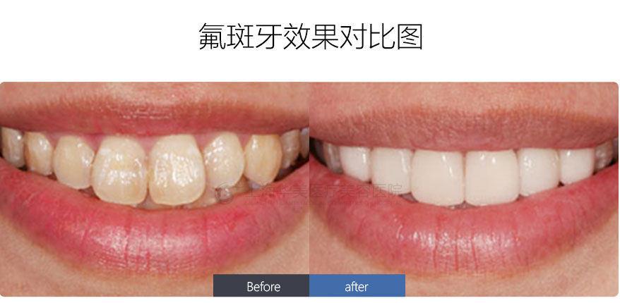 http://www.chicagonutritionsolutions.com/d/file/price/2SNFYPASP2.jpg