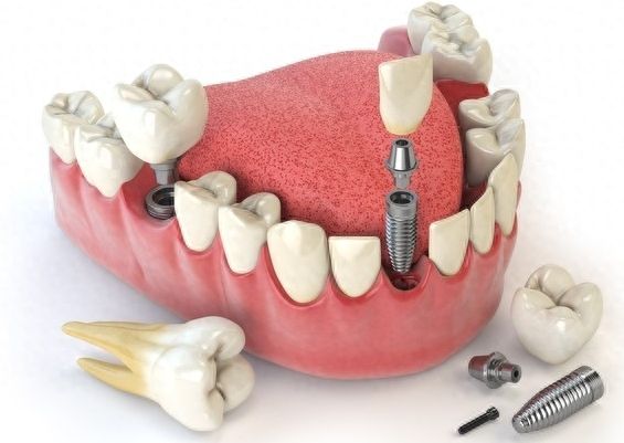 http://www.chicagonutritionsolutions.com/d/file/price/2b1a705j9wq5.jpg