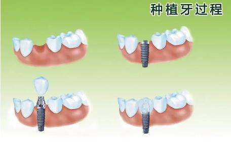 http://www.chicagonutritionsolutions.com/d/file/price/2c74zh2oid8g.jpg