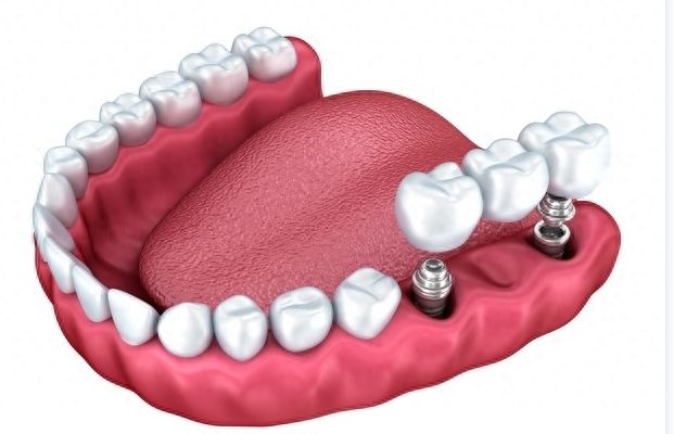 http://www.chicagonutritionsolutions.com/d/file/price/2hexk82vhk02.jpg
