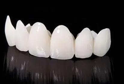 http://www.chicagonutritionsolutions.com/d/file/price/30V9KONDR3.jpg