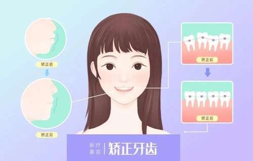 汕頭第二人民醫(yī)院口腔科口碑評(píng)價(jià)及牙齒正畸價(jià)格表