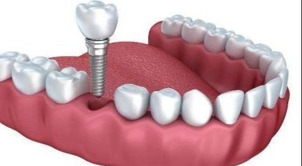 http://www.chicagonutritionsolutions.com/d/file/price/3r9id3udehox.jpg