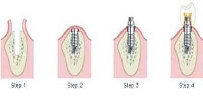http://www.chicagonutritionsolutions.com/d/file/price/3sj4b8gt1tlm.jpg