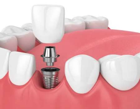http://www.chicagonutritionsolutions.com/d/file/price/4gvrilx610tt.jpg
