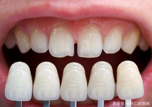 http://www.chicagonutritionsolutions.com/d/file/price/4sr39uedlp.jpg