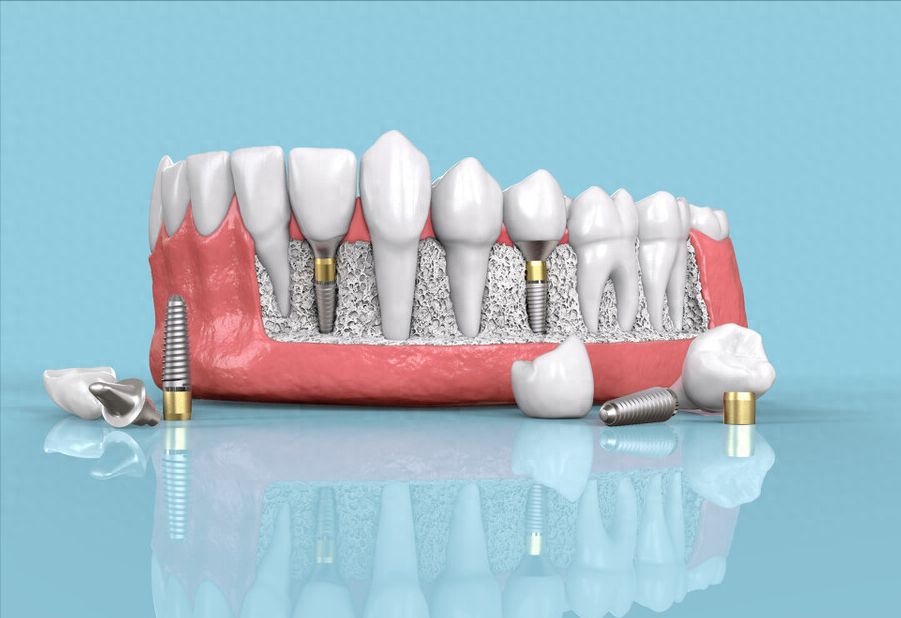 http://www.chicagonutritionsolutions.com/d/file/price/5g4kz7bzyoa9.jpg