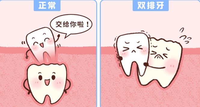 蚌埠三院牙齒矯正費(fèi)用全揭秘：透明標(biāo)價，品質(zhì)服務(wù)