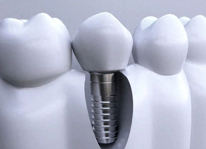 http://www.chicagonutritionsolutions.com/d/file/price/64ryozgppav0.jpg