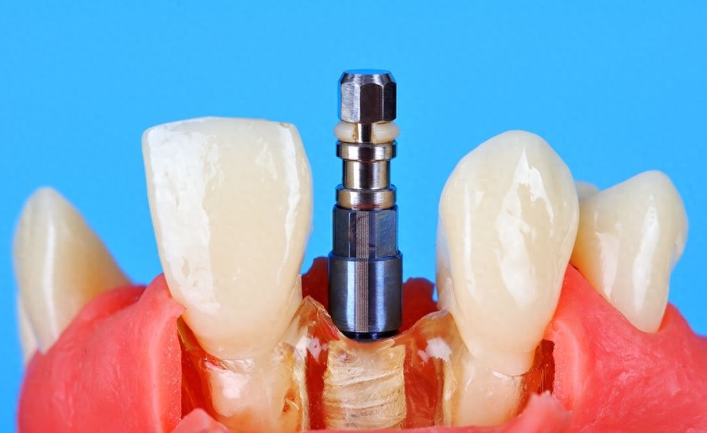 http://www.chicagonutritionsolutions.com/d/file/price/6bgksh1093ib.jpg
