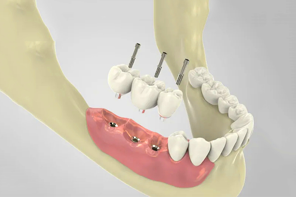 http://www.chicagonutritionsolutions.com/d/file/price/6evp3vuapdcz.jpg