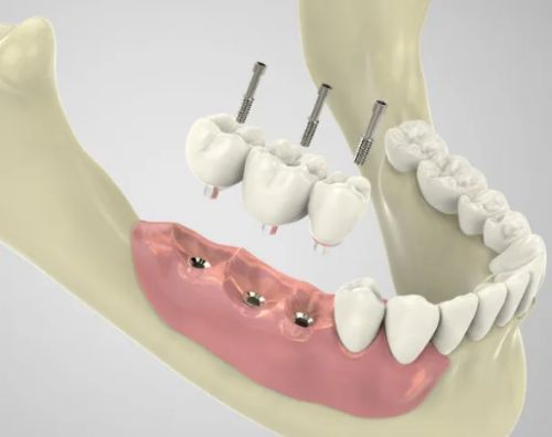 http://www.chicagonutritionsolutions.com/d/file/price/71w6kic68z9s.jpg
