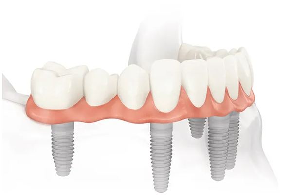 http://www.chicagonutritionsolutions.com/d/file/price/78xhqu4qbe.jpg