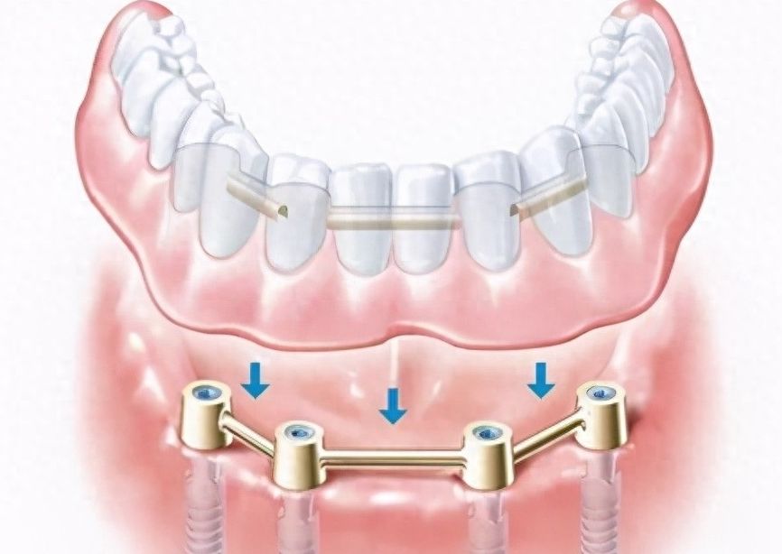 http://www.chicagonutritionsolutions.com/d/file/price/7v8plode6kq3.jpg