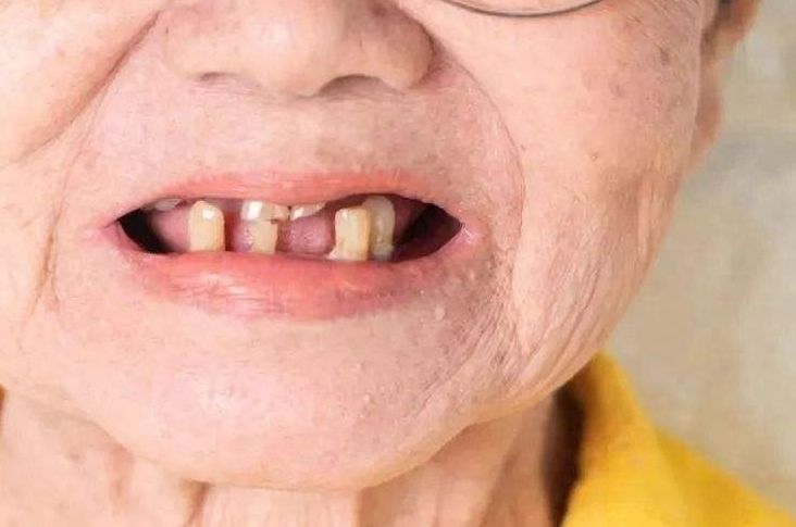 北京牙齒美白冷光價格查詢及技巧分享