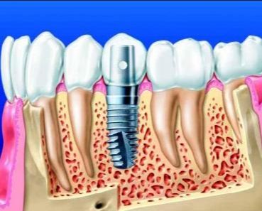 http://www.chicagonutritionsolutions.com/d/file/price/8iv2m5mtn0my.jpg