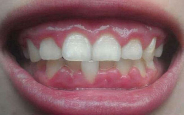 http://www.chicagonutritionsolutions.com/d/file/price/AIM7OY75KE.jpg