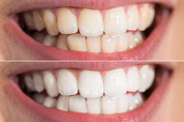 http://www.chicagonutritionsolutions.com/d/file/price/ASVIR933OX.jpg