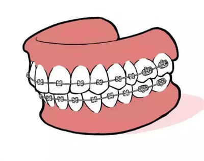 http://www.chicagonutritionsolutions.com/d/file/price/CPL62SR2S5.jpg