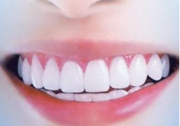 http://www.chicagonutritionsolutions.com/d/file/price/CV1CT59ME4.jpg
