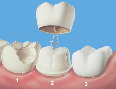http://www.chicagonutritionsolutions.com/d/file/price/EE0FDW0KW9.jpg