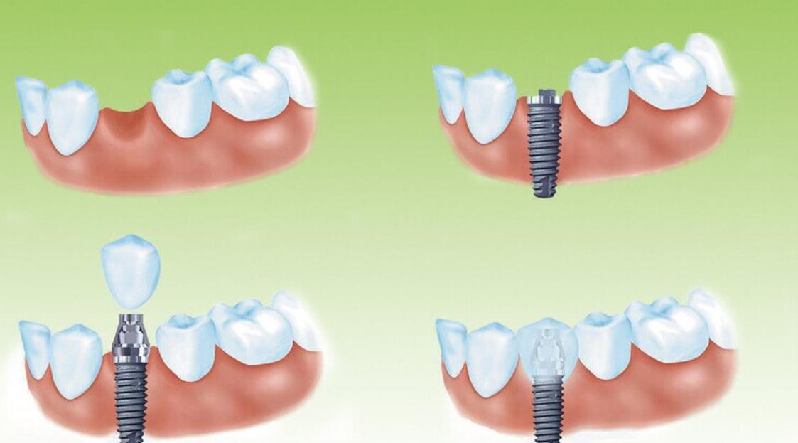http://www.chicagonutritionsolutions.com/d/file/price/F9NAXMA2XI.jpg