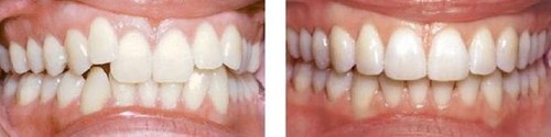 http://www.chicagonutritionsolutions.com/d/file/price/HF4XFDJQ87.jpg
