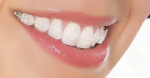 http://www.chicagonutritionsolutions.com/d/file/price/M4INFM0FNH.jpg