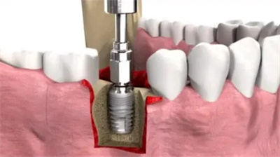 http://www.chicagonutritionsolutions.com/d/file/price/M87VV77473.jpg