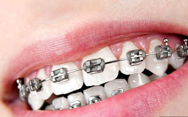 http://www.chicagonutritionsolutions.com/d/file/price/RLM2IOX8W6.jpg