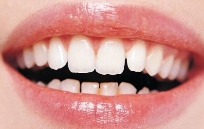 http://www.chicagonutritionsolutions.com/d/file/price/UZA57HXCG2.jpg