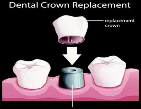 http://www.chicagonutritionsolutions.com/d/file/price/ap3wzls34uj6.jpg