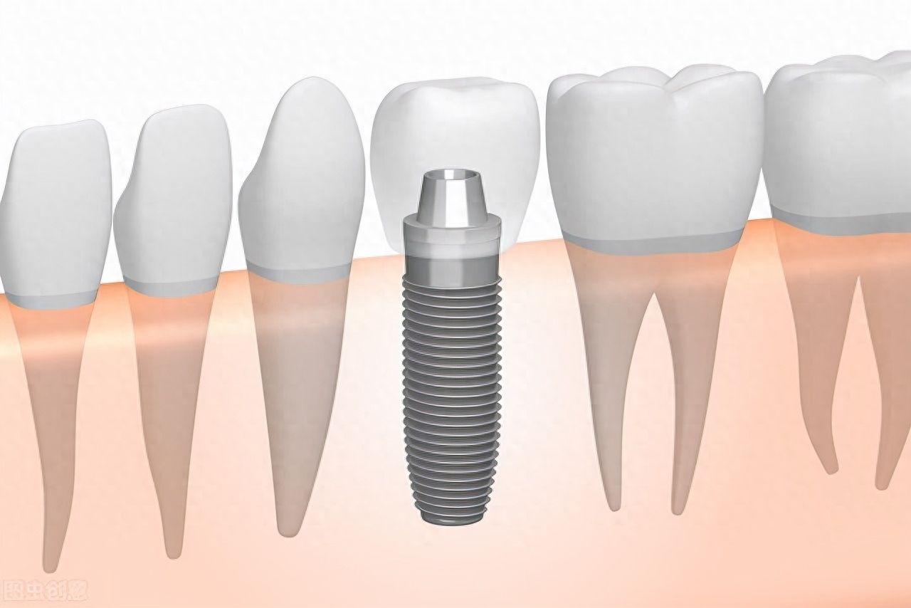 http://www.chicagonutritionsolutions.com/d/file/price/bv5umy9z003h.jpg
