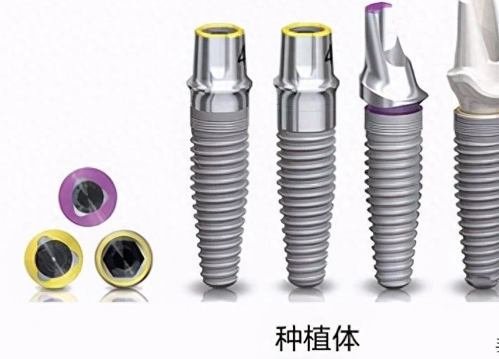 順義種植牙集采后，3家醫(yī)院價格對比