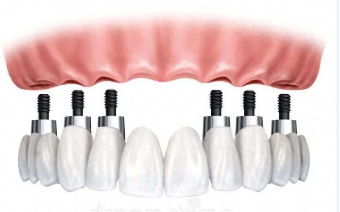 http://www.chicagonutritionsolutions.com/d/file/price/cp5le2smpwye.jpg