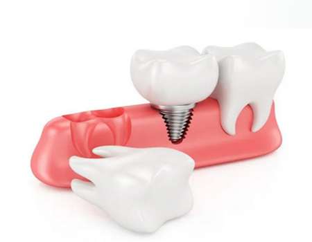http://www.chicagonutritionsolutions.com/d/file/price/crcugye70mdj.jpg