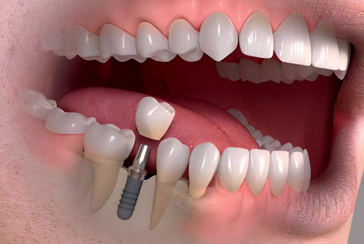 http://www.chicagonutritionsolutions.com/d/file/price/dvi7hd3b6lky.jpg