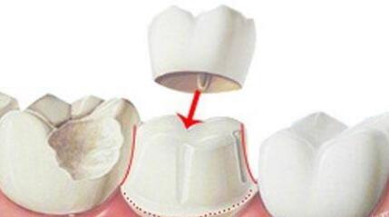 http://www.chicagonutritionsolutions.com/d/file/price/eapc430dhz.jpg