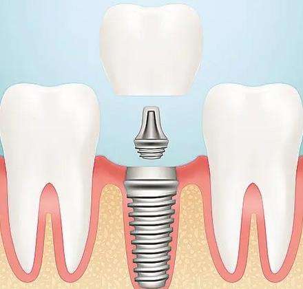 http://www.chicagonutritionsolutions.com/d/file/price/eow0ys46zpvx.jpg